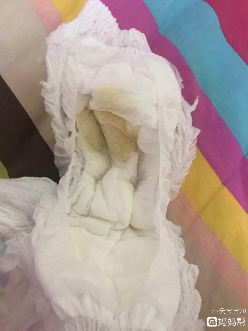 宝宝尿裤子变黄小便有问题吗_九个月宝宝小便有点黄_尿后提裤子滴尿正常吗