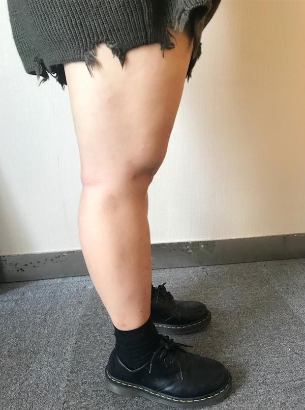 腿**先生_腿先生出来的孩子是有福吗_腿先生商标