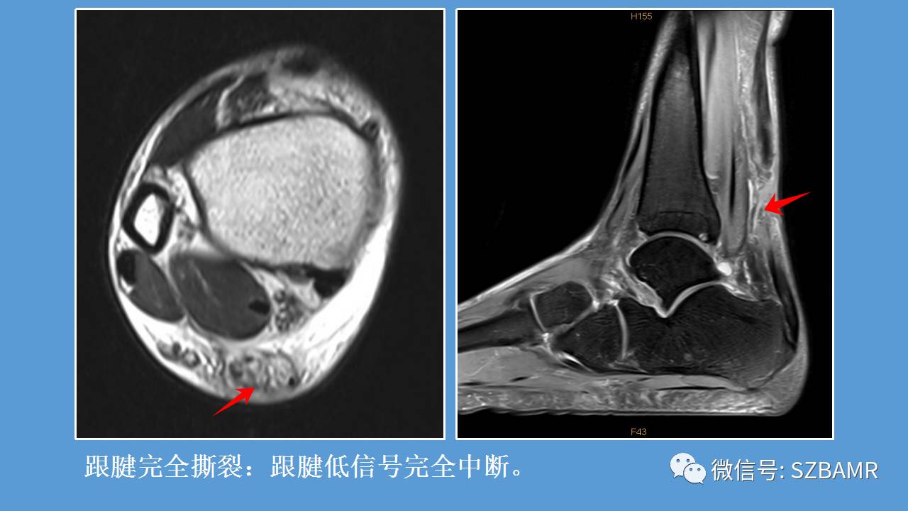 风神瞳共鸣石用了还是找不到_风神瞳共鸣石用了还是找不到_风神瞳共鸣石用了还是找不到