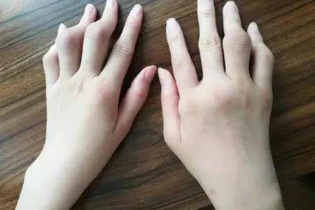 关节酸痛长期玩手机游戏会好吗_经常玩手机关节痛怎么办_长期玩手机游戏关节酸痛