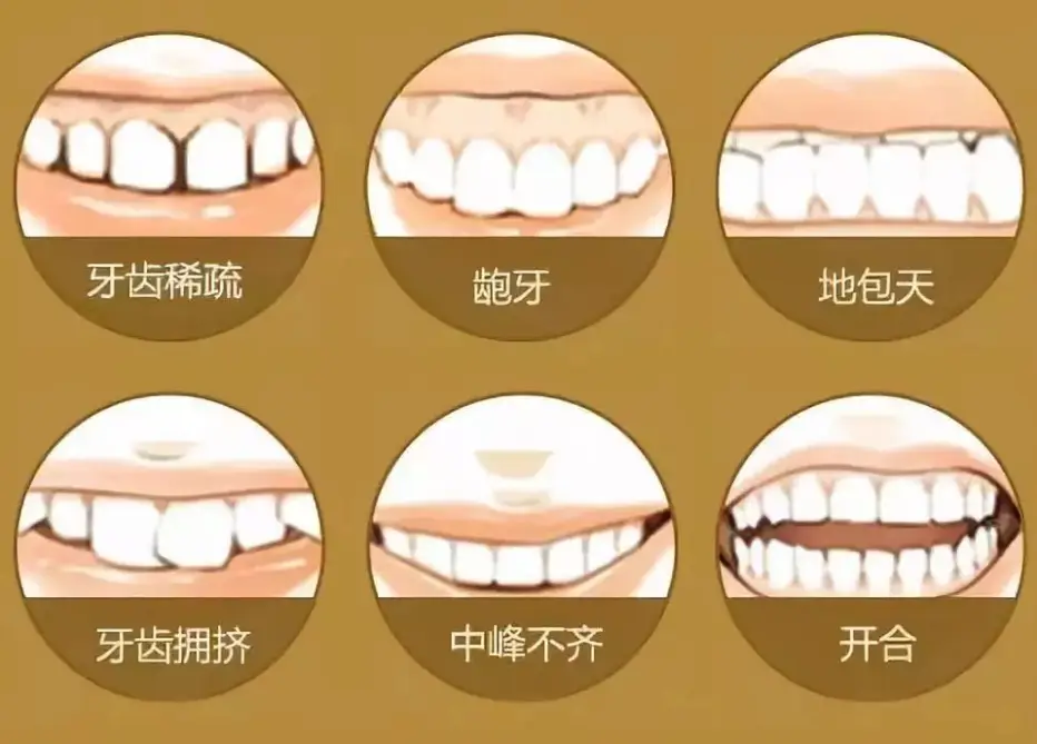 八重齿_快速扳手72齿与45齿_齿禹龋怎么读