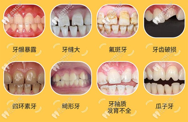 齿禹龋怎么读_八重齿_快速扳手72齿与45齿